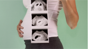 What to expect in the 1st Trimester